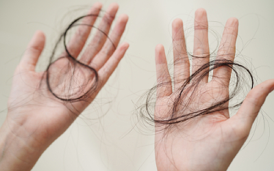 Выпадение волос от употребления Бензилморфина - клиника Угодие