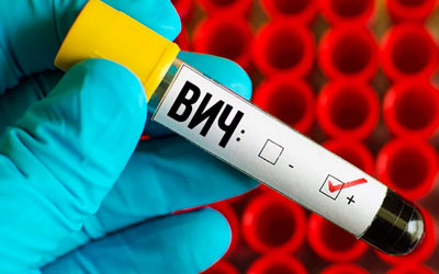 Наркозависимый повышает риск инфицирования ВИЧ- Угодие